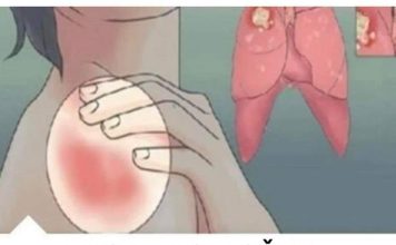 EVO KAKO MOŽETE PROVJERITI DA LI IMATE SLAB IMUNITET