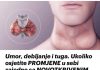 UMOR, DEBLJANJE I TUGA Ukoliko osjetite ove simptome nemojte ih ignorisati