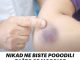Nikad ne bi pogodili kako modrice mogu biti opasne!!