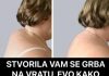 STVORILA VAM SE GRBA NA VRATU, EVO KAKO ĆETE JE ISPRAVITI