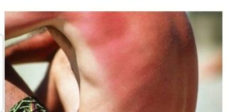 NE POMAŽE JOGURT, OVA MAJKA JE OTKRILA TRIK GODINE