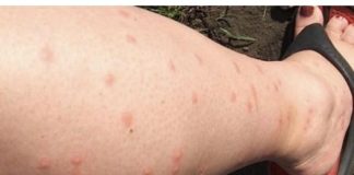 Ako vam komarci prave haos samo isijecite ovu vocku i nece ih biti!!