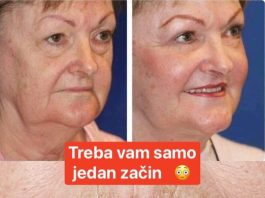 NE BACAJTE PARE NA KREME: Operite lice sa ovim začinom i gledajte kako bore nestaju