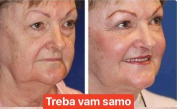 NE BACAJTE PARE NA KREME: Operite lice sa ovim začinom i gledajte kako bore nestaju