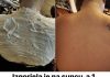 Ako ste izgorili na suncu ovaj trik ce vam sigurno pomoci