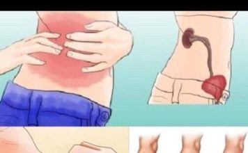 KADA SA BUBREZIMA NIJE SVE UREDU TIJELO ŠALJE OVE SIGNALE