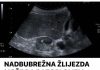 NADBUBREŽNA ŽLIJEZDA MOŽE DA RAZORI CIJELI ORGANIZAM