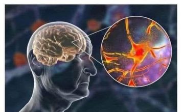 Najbolja namirnica protiv demencije!!