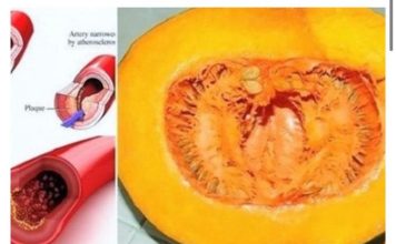 KORISTEĆI OVAJ RECEPT RECITE ZBOGOM POVIŠENOM HOLESTEROLU, ŠEĆERU U KRVI, MASNOĆI I TRIGLICERIDIMA