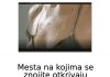 MIJESTA NA KOJIM SE ZNOJITE GOVORI MNOGO O VAŠEM ZDRAVLJU