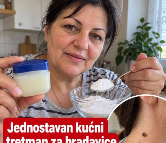 Vazelin i bradavice: Kako zaštititi kožu i ublažiti iritaciju na jednostavan način?